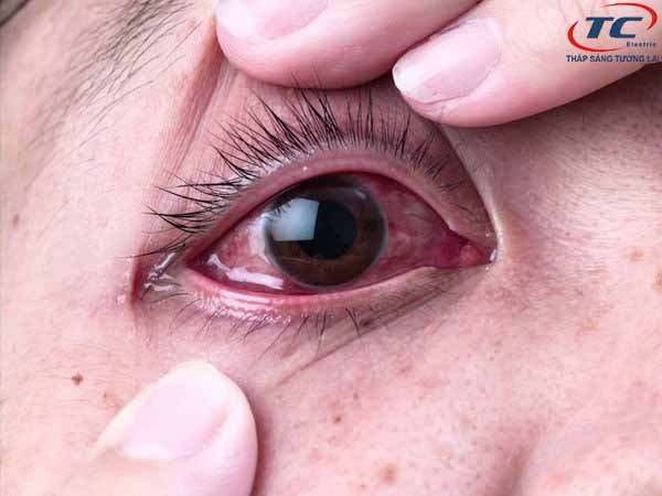 Gây đau mắt hoặc tổn thương đến mắt